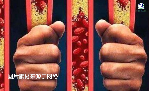 不想給血管“添堵”，盡量少吃以下這些東西，或許能讓腦梗離遠(yuǎn)些  